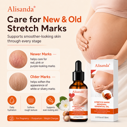 Alisanda® SilkStretch Natural Stretch Mark & Scar Oil