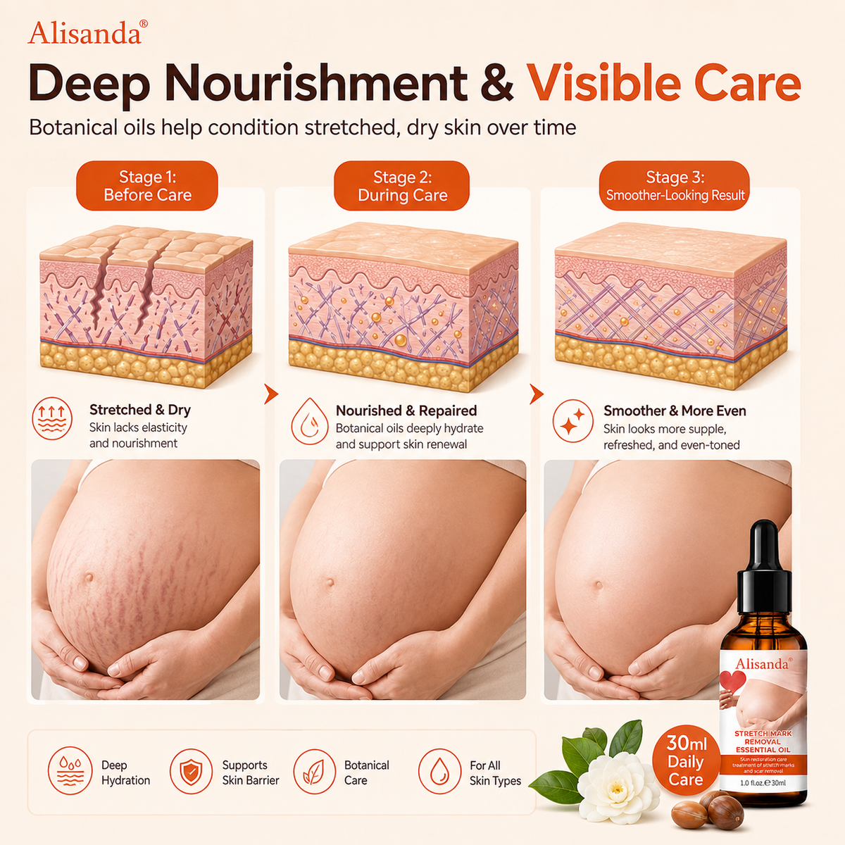 Alisanda® SilkStretch Natural Stretch Mark & Scar Oil