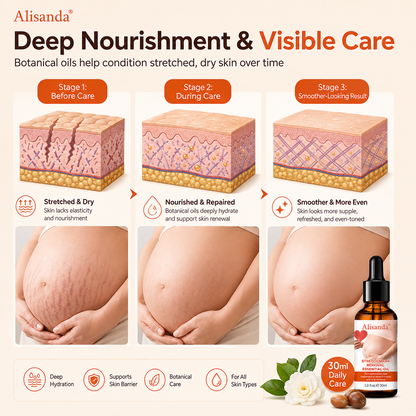 Alisanda® SilkStretch Natural Stretch Mark & Scar Oil