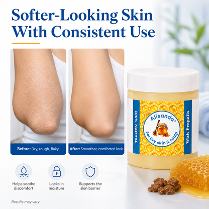 Alisanda® - Repair Balm For Eczema & Psoriasis