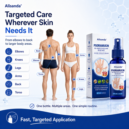 Alisanda® PsoriaMucin No-Rub Itch & Flake Relief Mist