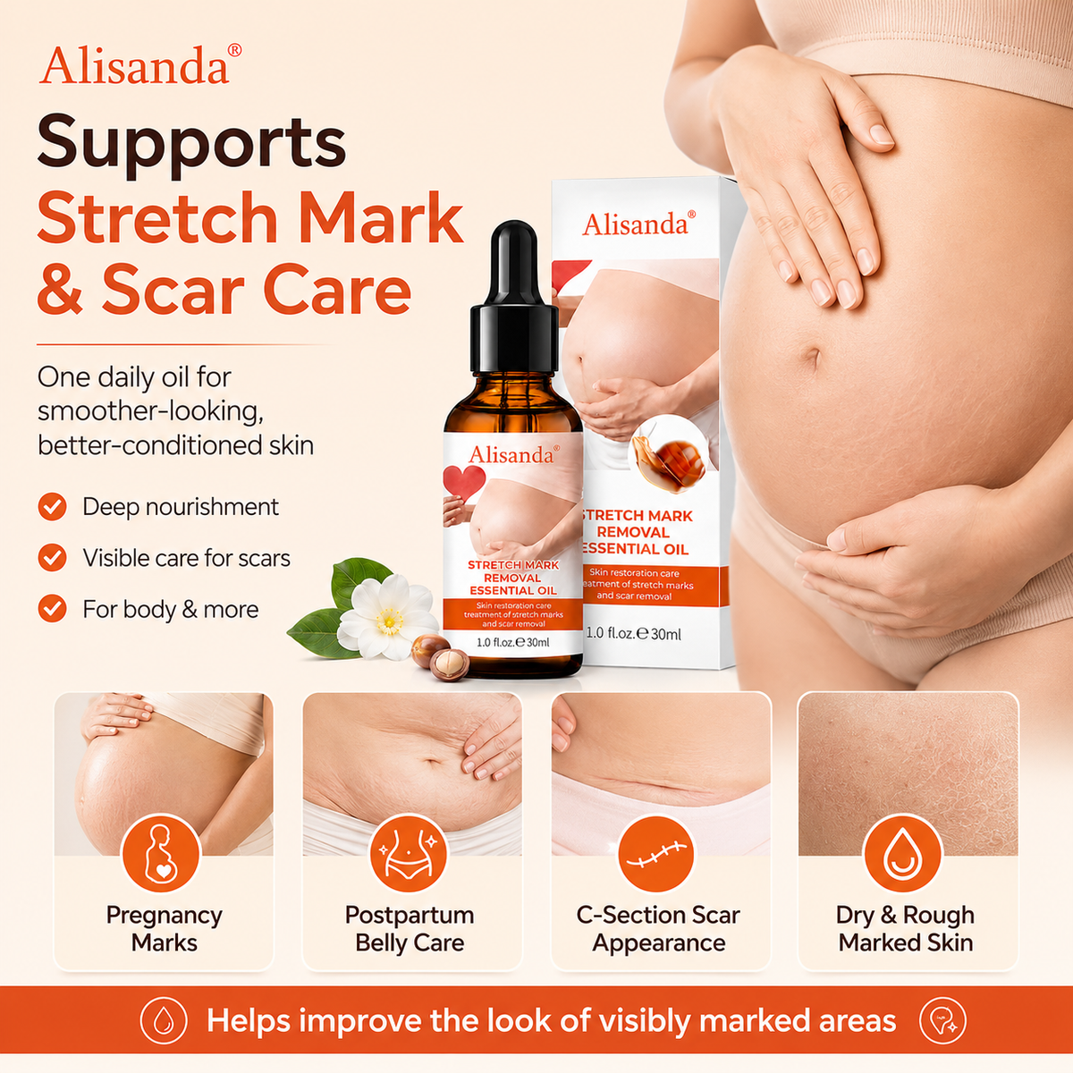 Alisanda® SilkStretch Natural Stretch Mark & Scar Oil