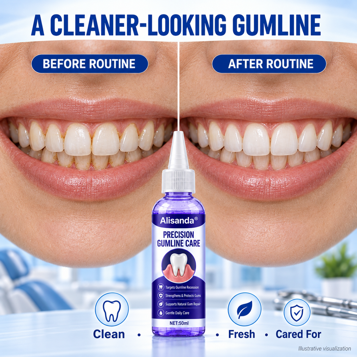 Alisanda® 🦷Periodontal Care Gel 📍