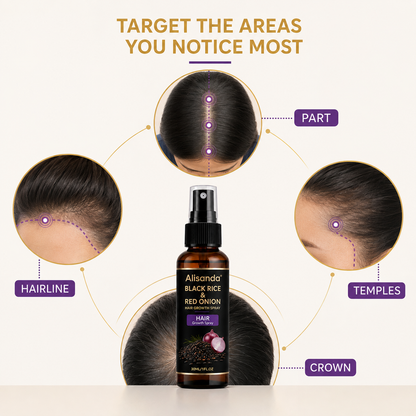 🔥Alisanda® Black Rice & Red Onion Hair Growth Spray