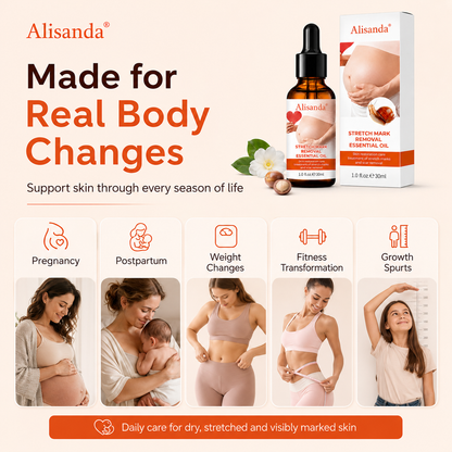 Alisanda® SilkStretch Natural Stretch Mark & Scar Oil