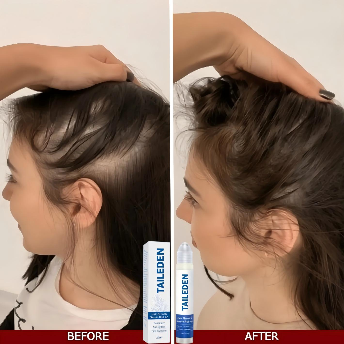 TAILEDEN Pro-Growth Roll-On Hair Growth Serum | Fuller Hair & Firmer Scalp